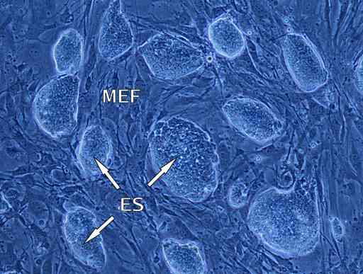 Kolonie komórek ES